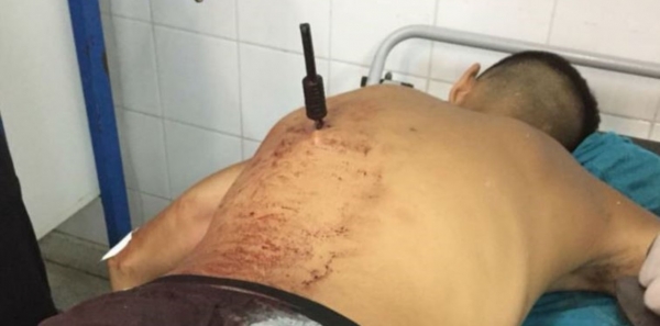Una joven de 22 años se defendió de un motochorro de 16 y le clavó un cuchillo en la espalda