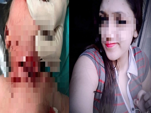 Joven dio a luz en su casa y le cortó el cuello a la beba con una tijera