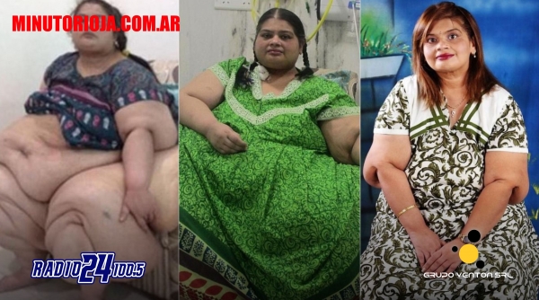 Llegó a pesar 298 kilos y logró perder la mitad en cuatro años